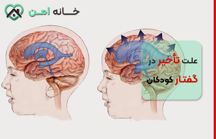 تأخیر در گفتار کودکان